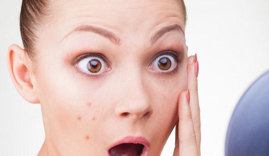 La pelle di faccia grossa e costantemente nota