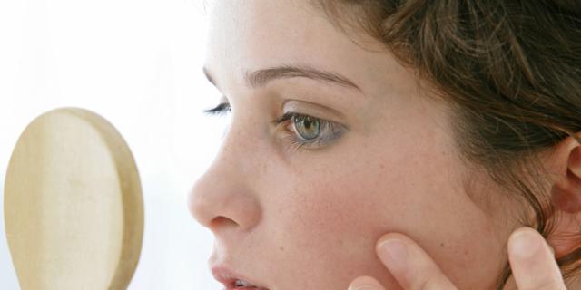 Argilla azzurra per unacne