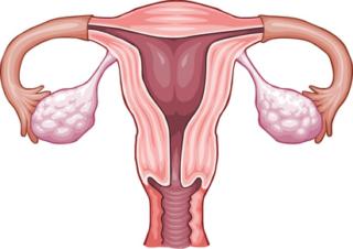 Endometriosi: gli esami per scoprirla e le cure più indicate