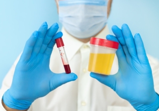 analisi sangue e urine