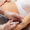Dubbi sui test del sangue materno per la sindrome di Down