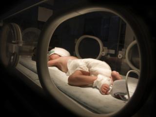 Il parto prematuro interrompe lo sviluppo del cervello