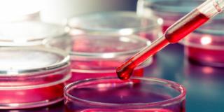 Celiachia: un nuovo test per la diagnosi precoce