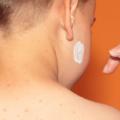 Psoriasi: nei bambini si cura così