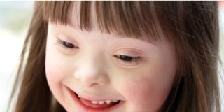 Sindrome di Down: utile la colina in gravidanza e allattamento