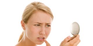 Acne: attenzione che in inverno peggiora