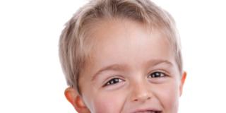 La carie nei bambini si combatte con il dentifricio (al fluoro)