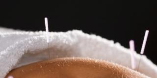 Fecondazione assistita: più chance con l’agopuntura?