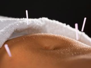 Fecondazione assistita: più chance con l’agopuntura? 