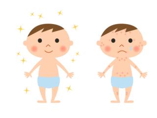 Dermatite da contatto: cosa è e come curarla nel bambino
