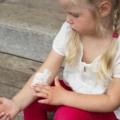 Dermatite atopica: sintomi e cure della malattia pediatrica più comune
