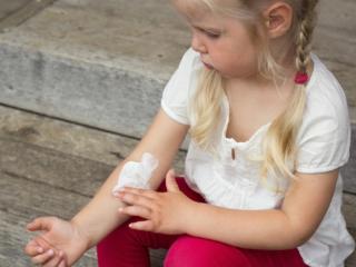 Dermatite atopica: sintomi e cure della malattia pediatrica più comune
