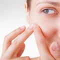 Acne: i rimedi fai-da-te non sempre sono sicuri