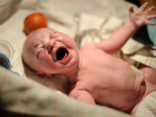 Ferro per il neonato: basta il cordone ombelicale