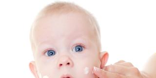 Dermatite atopica nel neonato