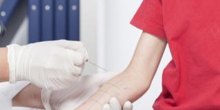 Esame prick test per accertamento allergia