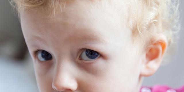 Circoncisione nei bambini: a che età si fa e quando è necessaria