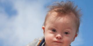 Sindrome di Down: perché a rischio le mamme mature