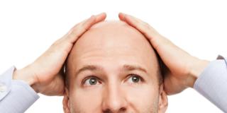 Infertilità maschile: un legame con la caduta dei capelli?