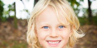 Denti a macchie: è la malattia dei bambini del 2000