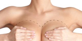 Seno: l’intervento fa ancora paura