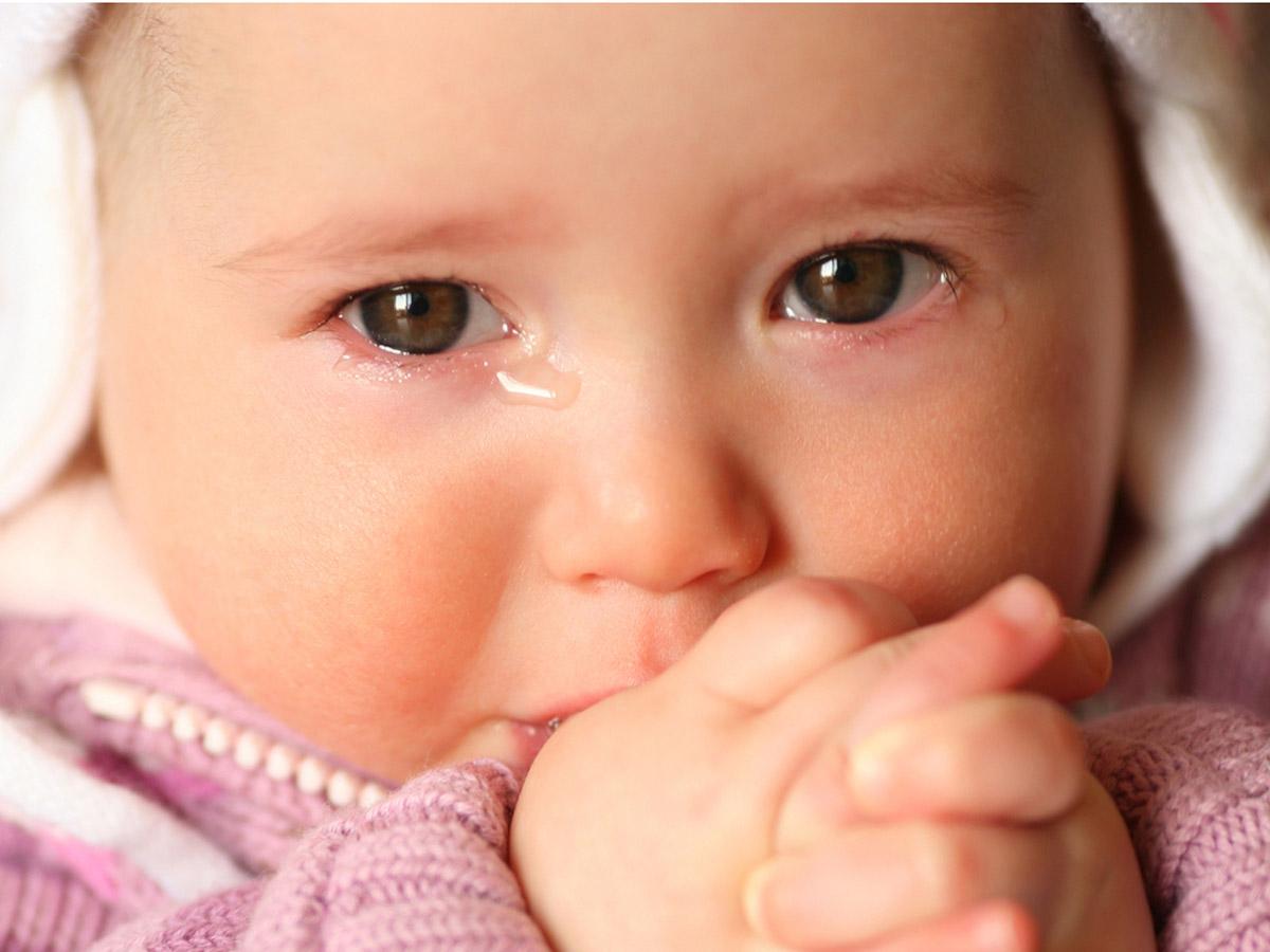 Ребенок температура слезятся глаза. Непроходимость носослезного канала. Ребенок плачет. Дакриоцистит новорожденных. Непроходимость слезы у новорожденных.
