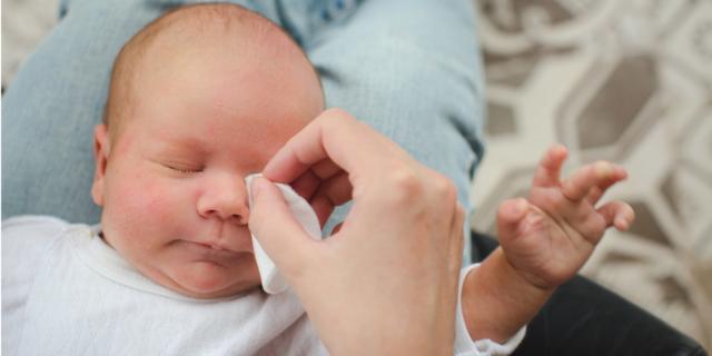 Congiuntivite nel neonato: sintomi, rimedi e quanto dura
