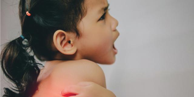 Malaria: sintomi, come si trasmette e la situazione in Italia