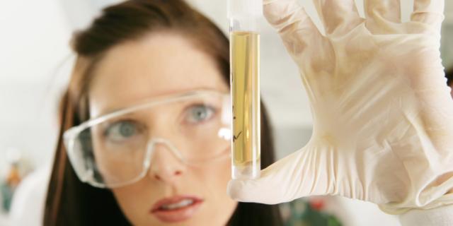 Scopri se il bambino si ammalerà dall’analisi delle urine