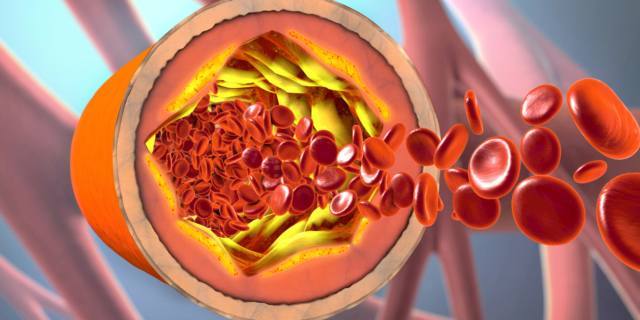 Colesterolo buono… ma non troppo