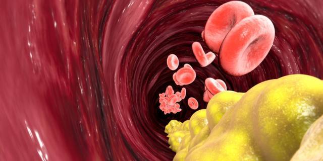 Il colesterolo buono tiene sotto controllo la glicemia