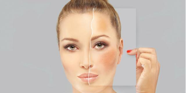 Macchie scure, le soluzioni per eliminarle