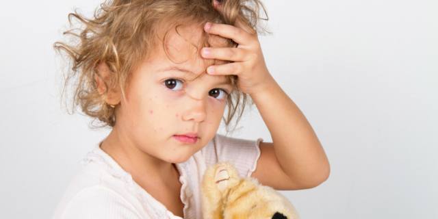 Morbillo: in Europa il contagio continua