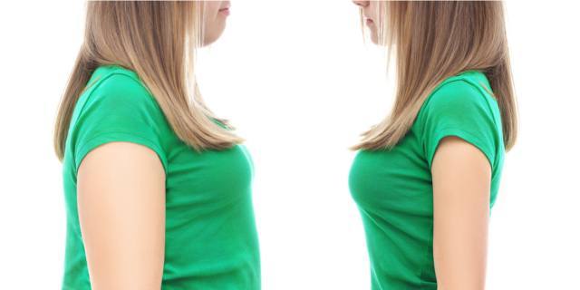 Adolescenti obesi: microbiota alterato