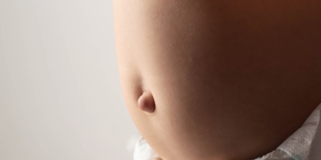 Ernia ombelicale nel neonato: cosa fare e quando preoccuparsi