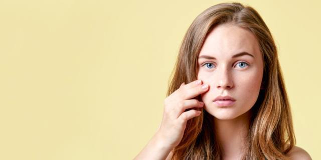 La vitamina A combatte l’acne