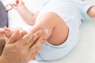 Eczema e allergie nei bambini: c’è un legame