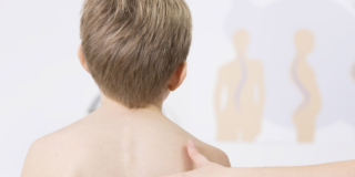 Come riconoscere la scoliosi nei bambini e nei ragazzi: i segnali da valutare