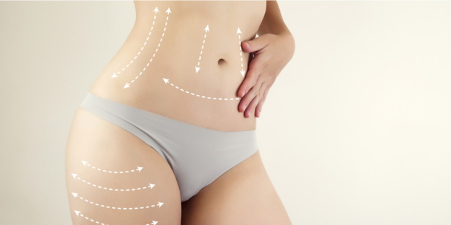 Chirurgia estetica: c’è di nuovo voglia di ritocchino