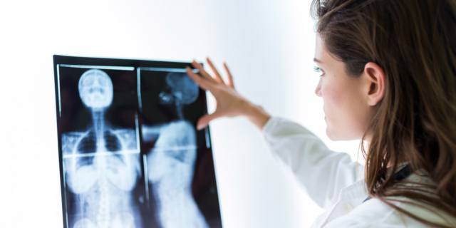 Tumore al polmone, nuove cure allungano la speranza di vita