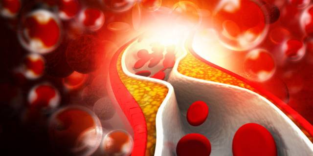 Colesterolo alto: in arrivo i super farmaci che lo dimezzano