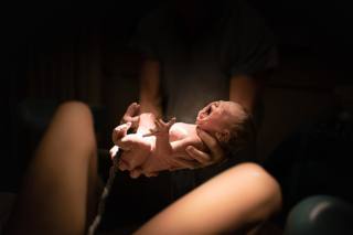 Il parto cesareo può danneggiare il microbiota intestinale del bebè