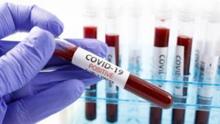 Covid-19: chi ha il gruppo sanguigno A corre più rischi