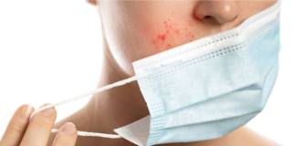 Acne da mascherina: via al movimento di liberazione social