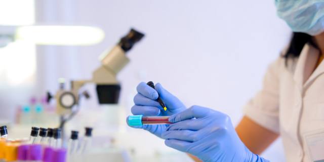 Diagnosi precoce: un test del sangue aiuta a individuare 50 tipi di tumori  in anticipo