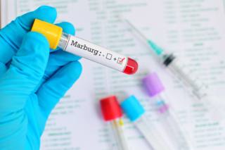 Virus Marburg: rischio basso per l’Italia