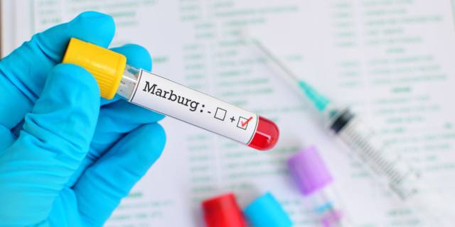 Virus Marburg: rischio basso per l’Italia