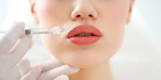 Medicina estetica: labbra rifatte, le tecniche soft per migliorarle