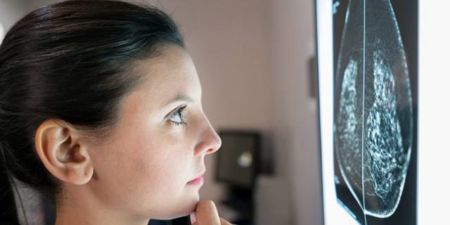 Carcinoma mammario avanzato: un nuovo farmaco allunga la vita