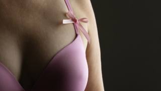 Tumore al seno: un test molecolare potrà evitare chemio inutili?
